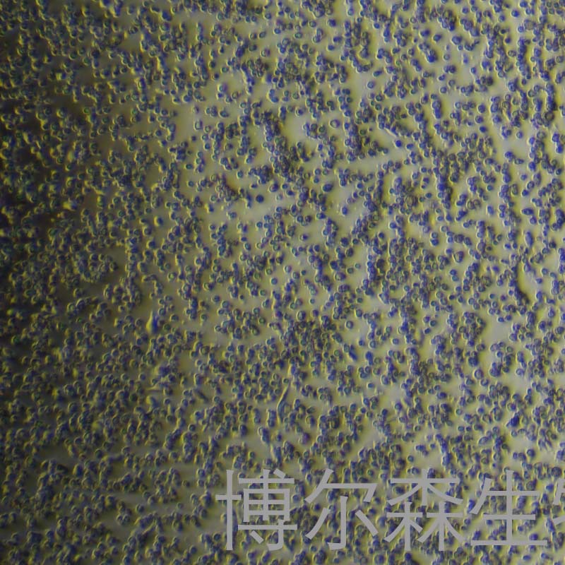 OVTOKO （人卵巢癌细胞）