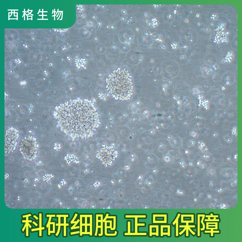 人肺微血管内皮细胞