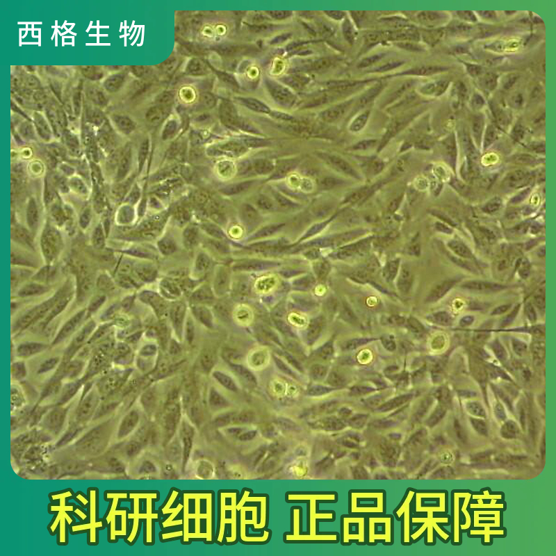 人肺微血管内皮细胞