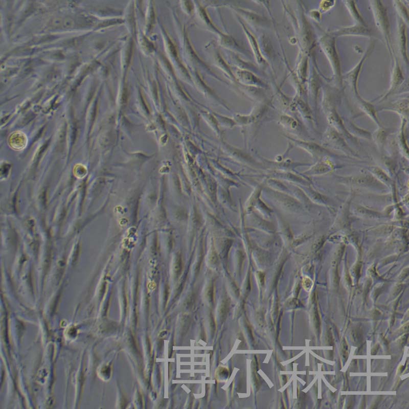 人子宫内膜基质细胞永生化