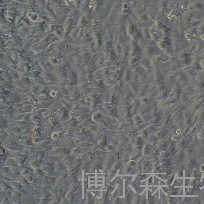 人小梁网细胞永生化