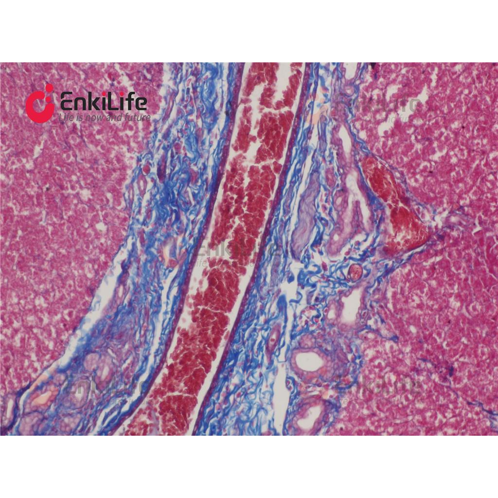 Masson三色染色液