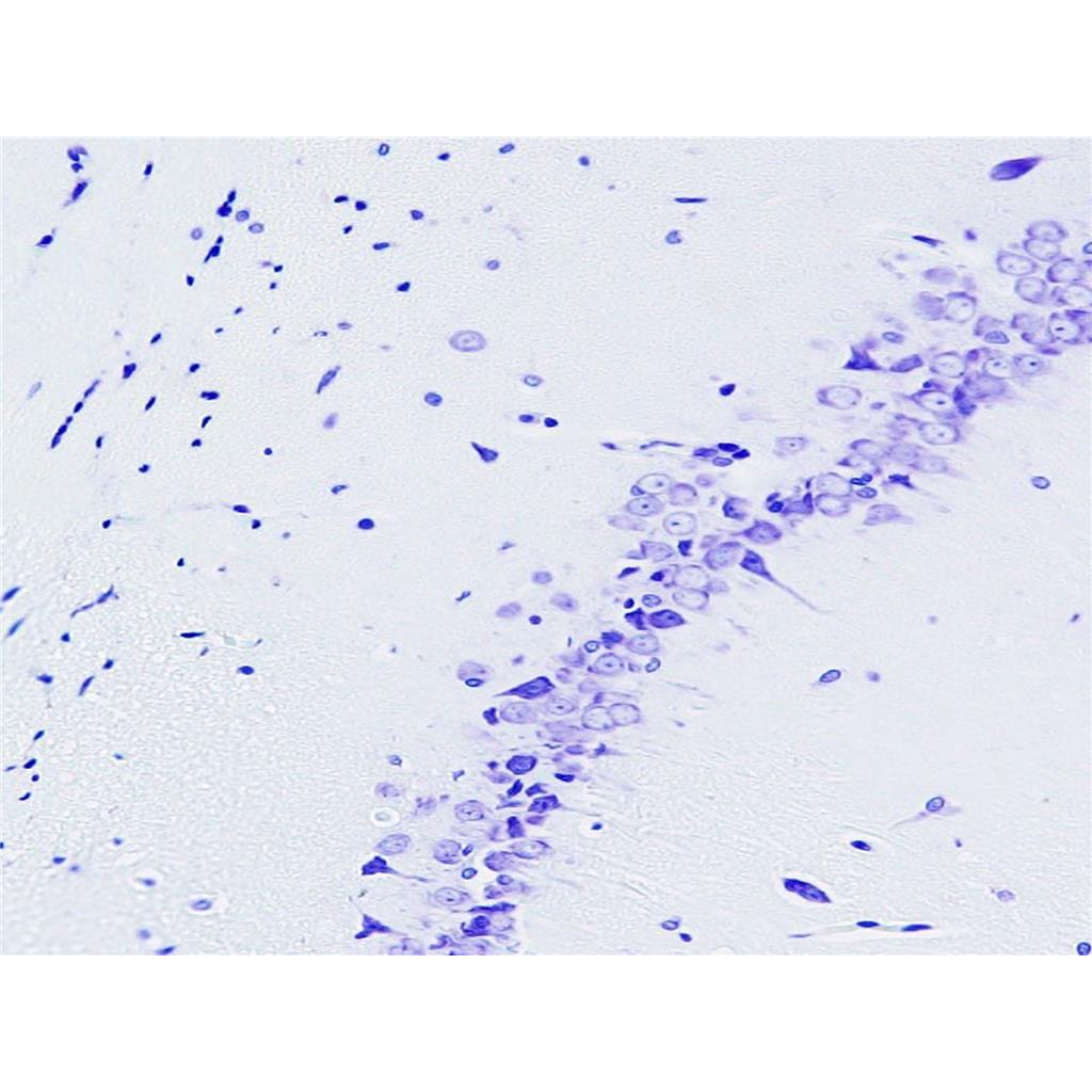 尼氏染色液(焦油紫法)