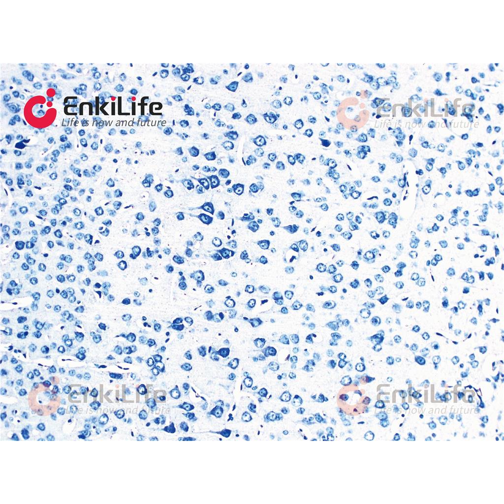 尼氏染色液(甲苯胺蓝法)