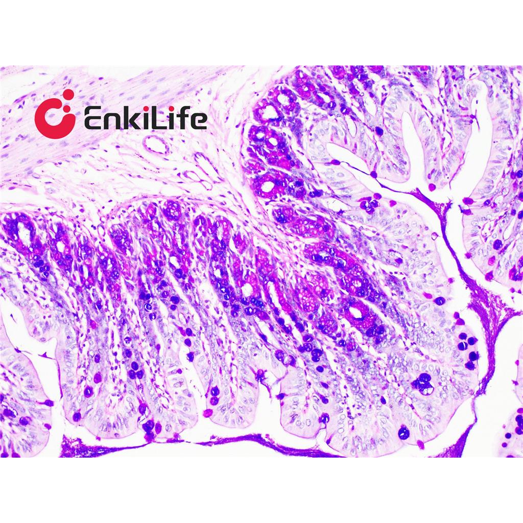 阿利新蓝-过碘酸雪夫(AB-PAS)染色液