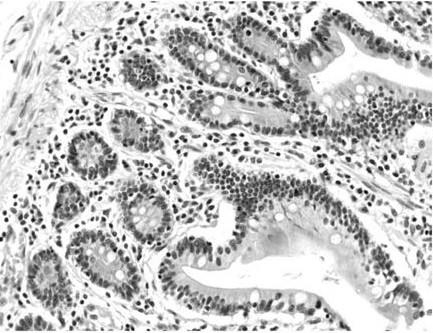 Weigert铁苏木素染色液