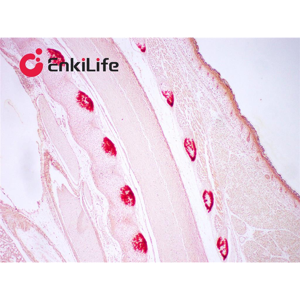 茜素红S染色液(0.1%,pH4.2)