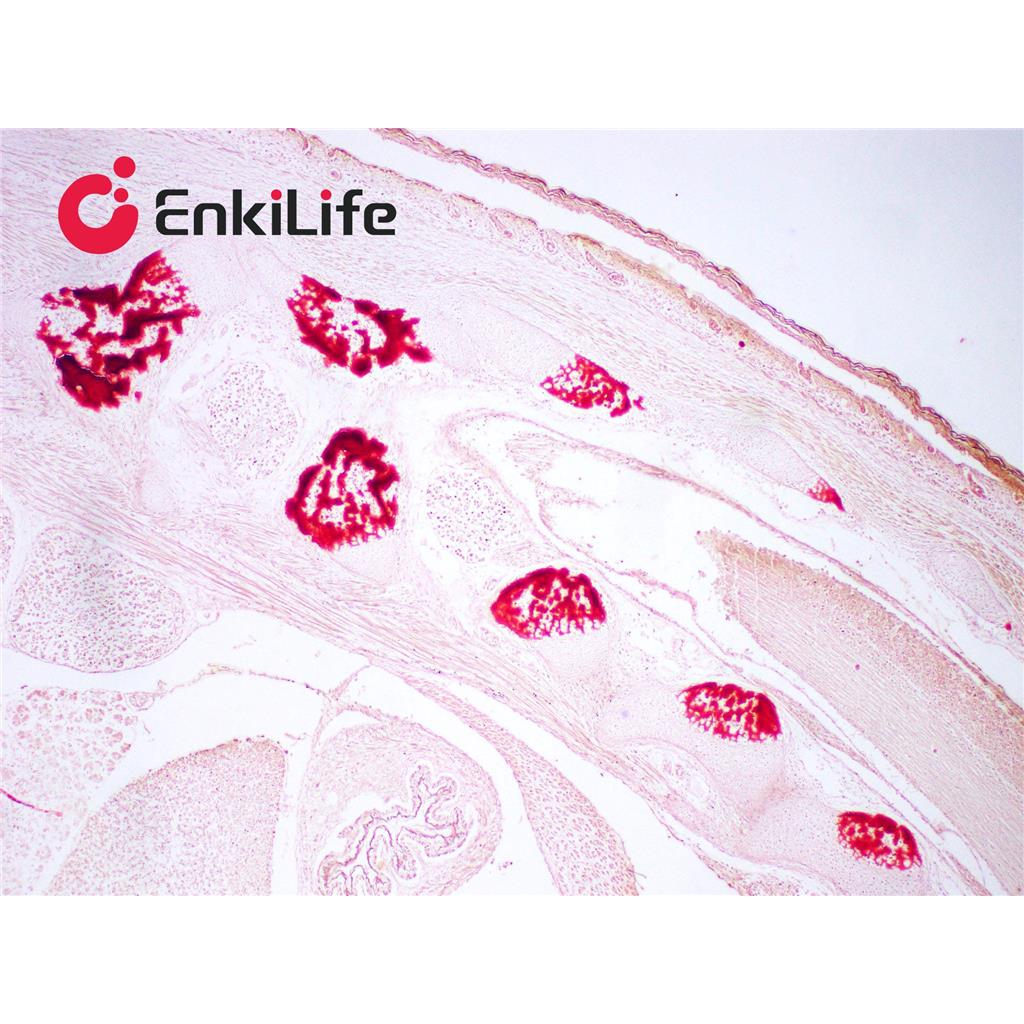 茜素红S染色液(0.2%,pH4.2)
