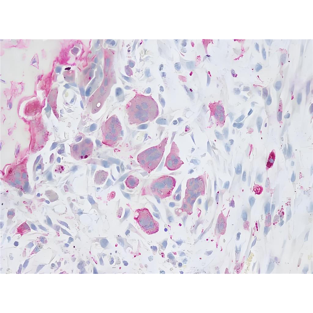 抗酒石酸酸性磷酸酶(TRAP)染色液