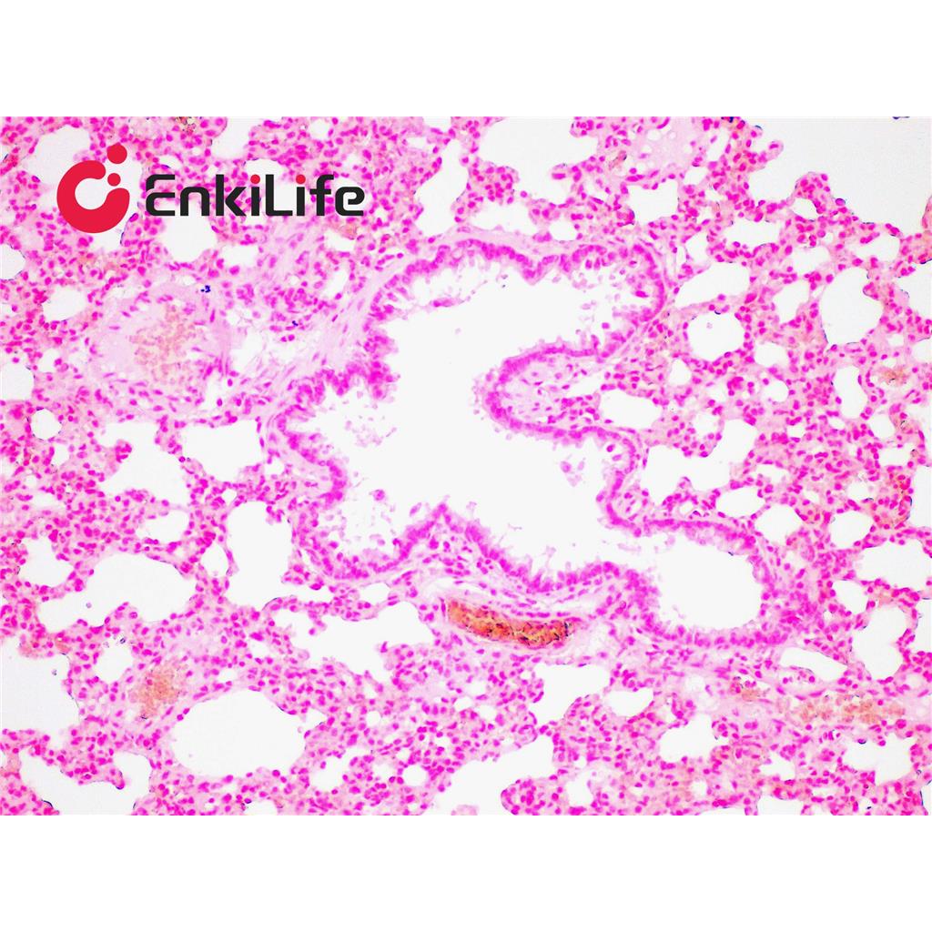 核固红染色液(0.2%)