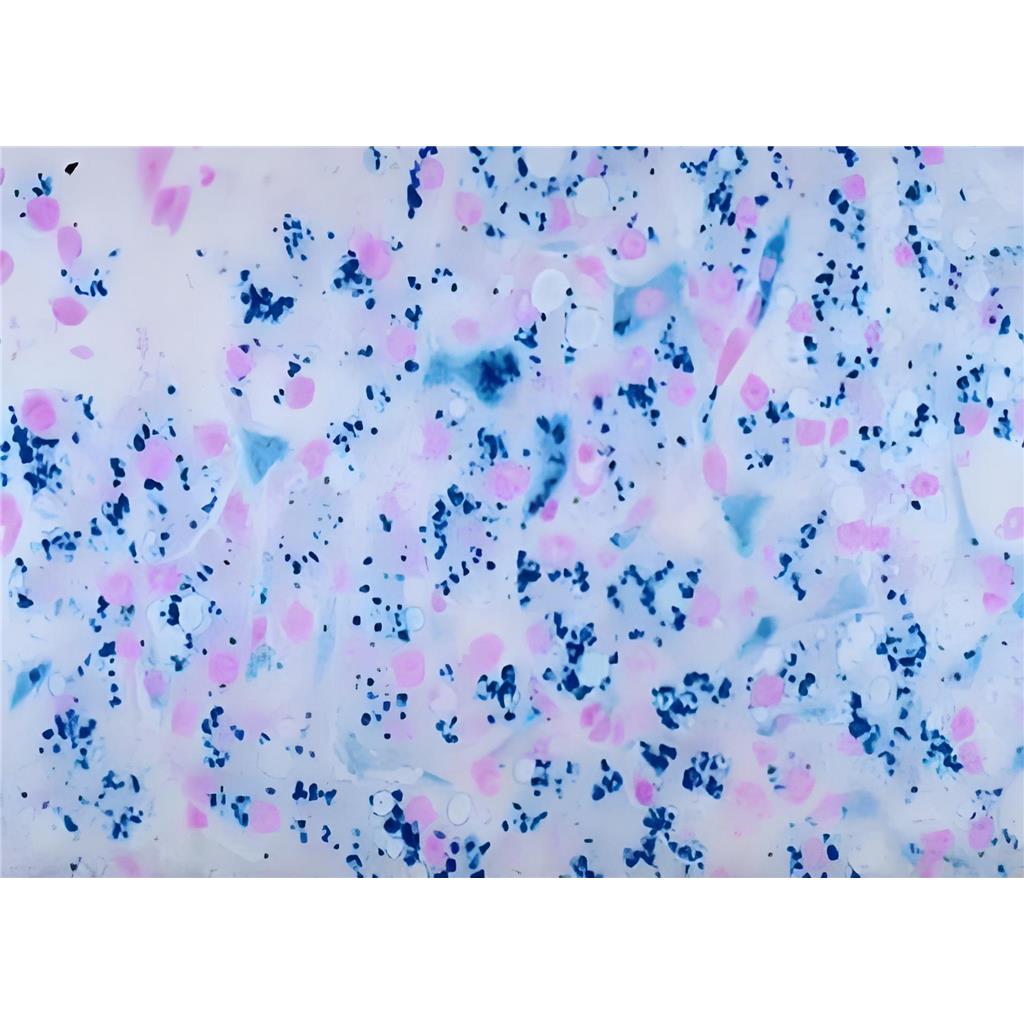 普鲁士蓝染色液(核固红法)