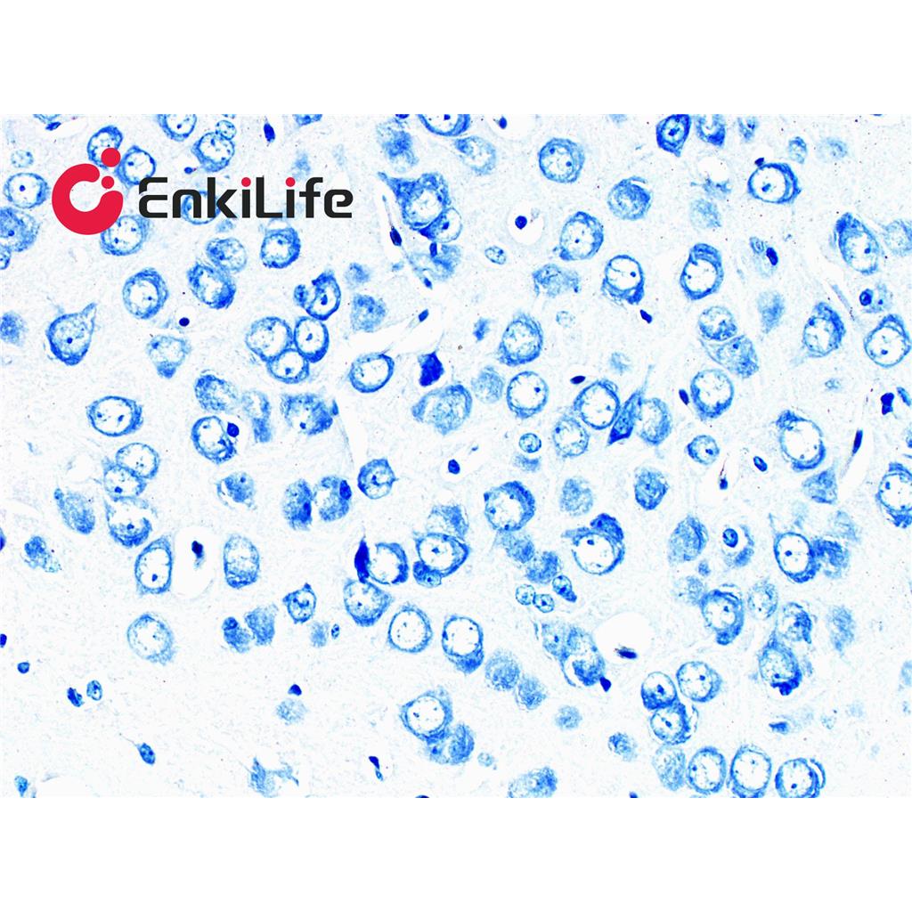 甲苯胺蓝染色液(0.5%,磷酸盐法)