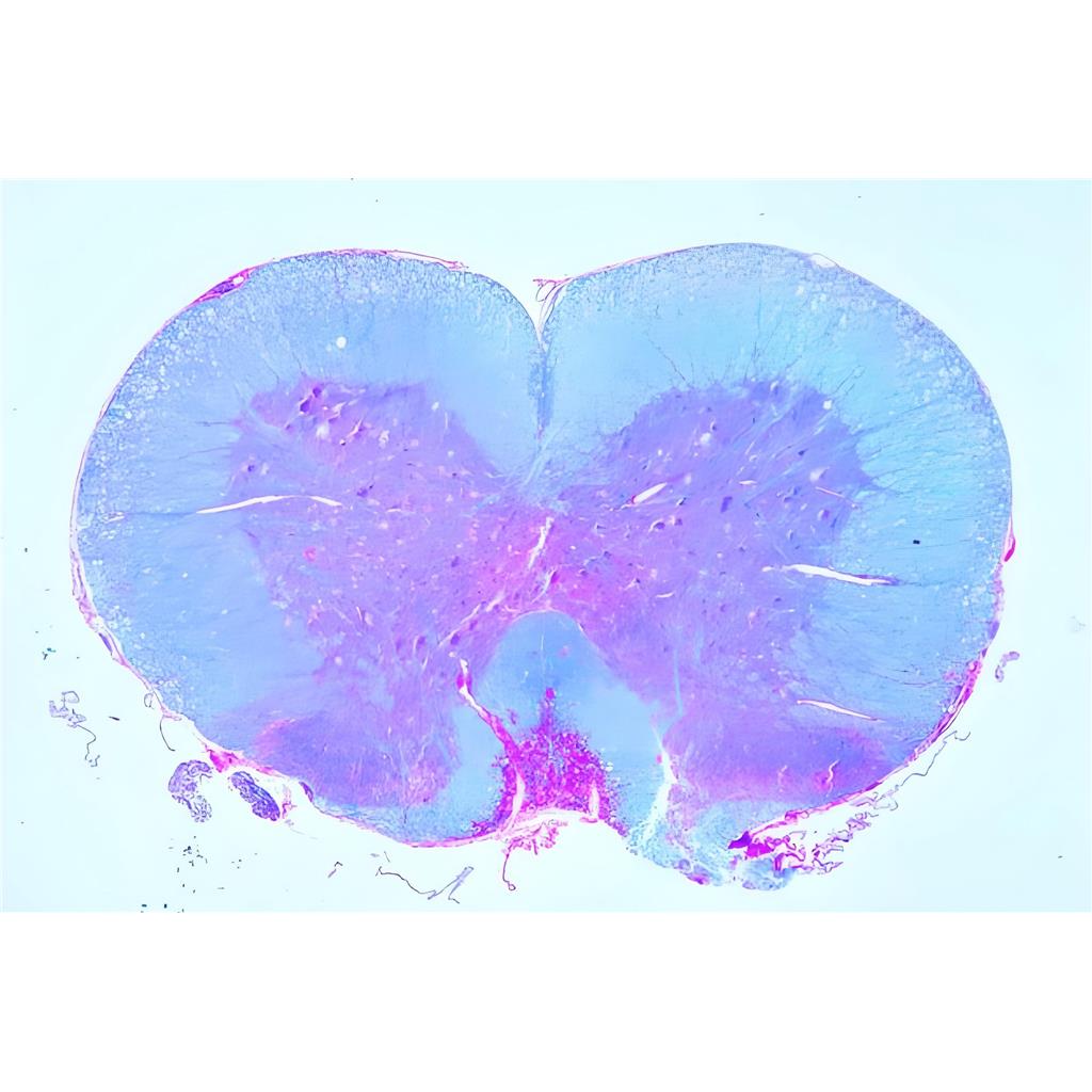 髓鞘染色液（LFB法）
