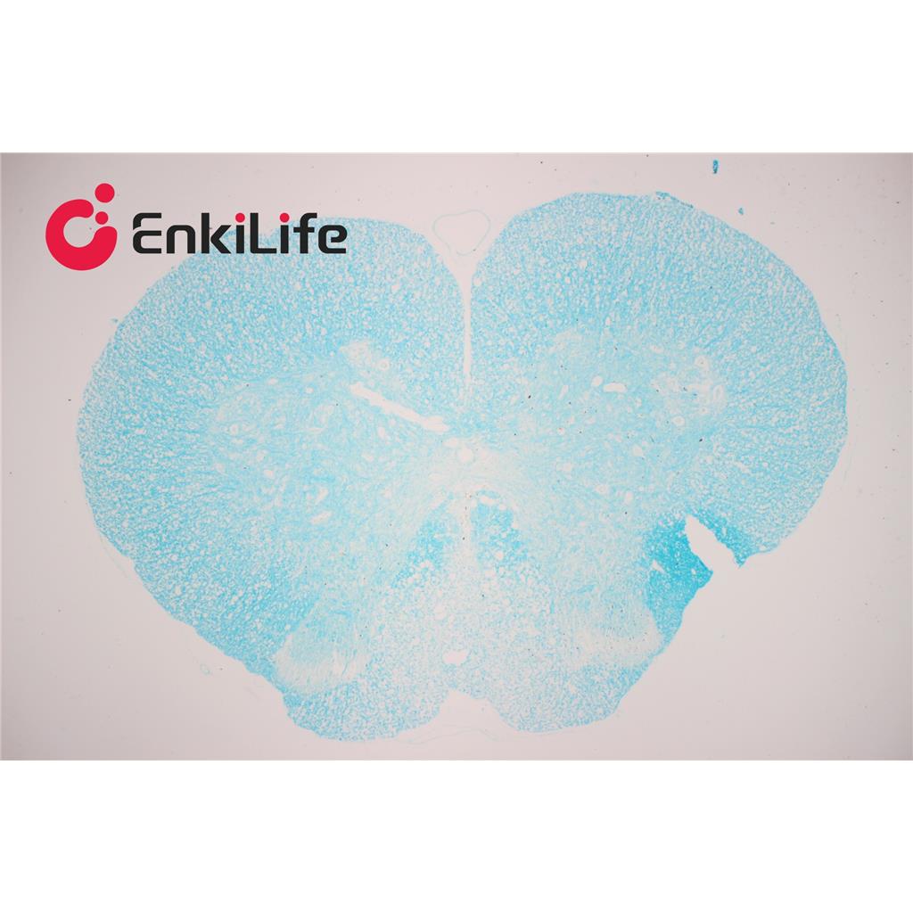 髓鞘染色液(固绿法)