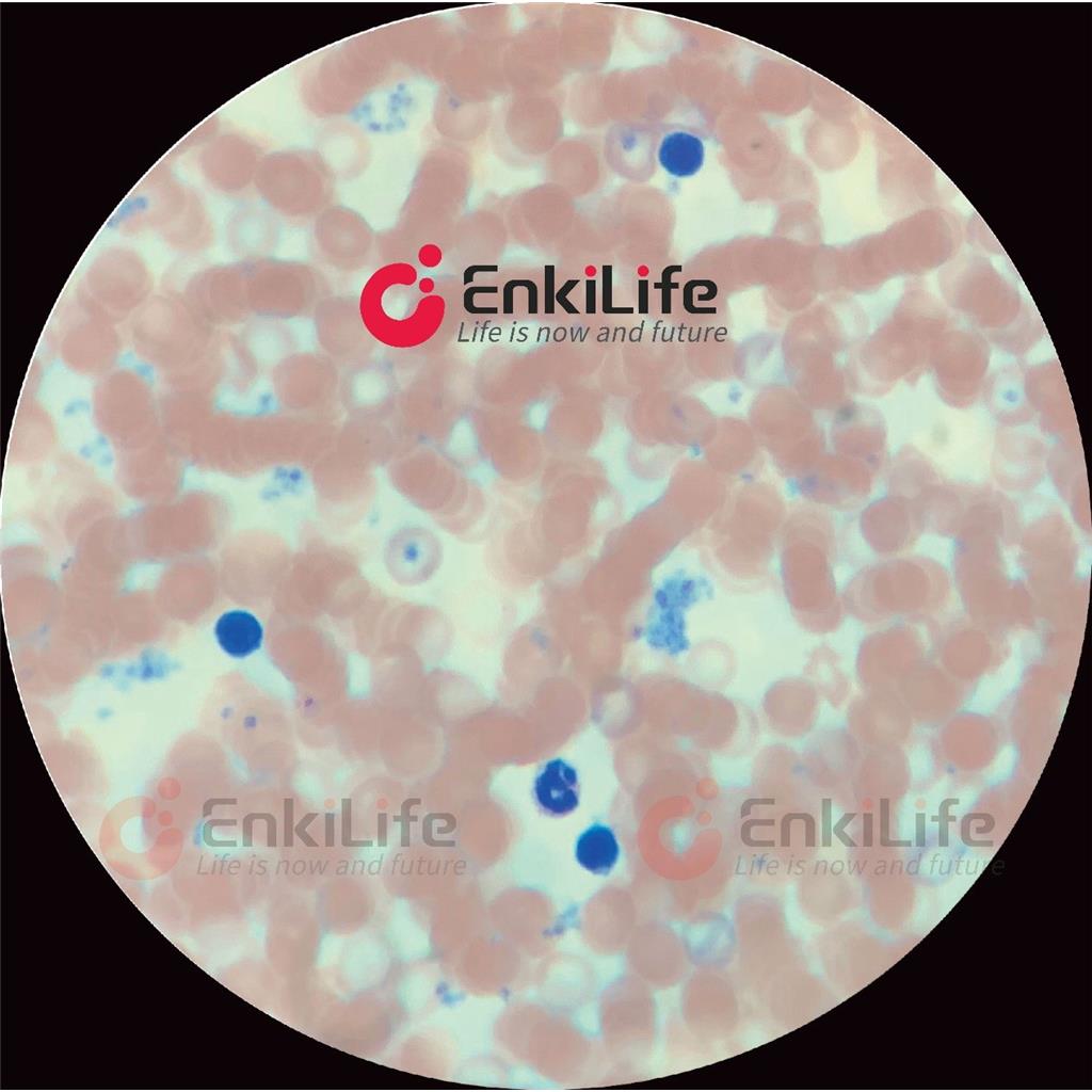 瑞氏-吉姆萨染色液