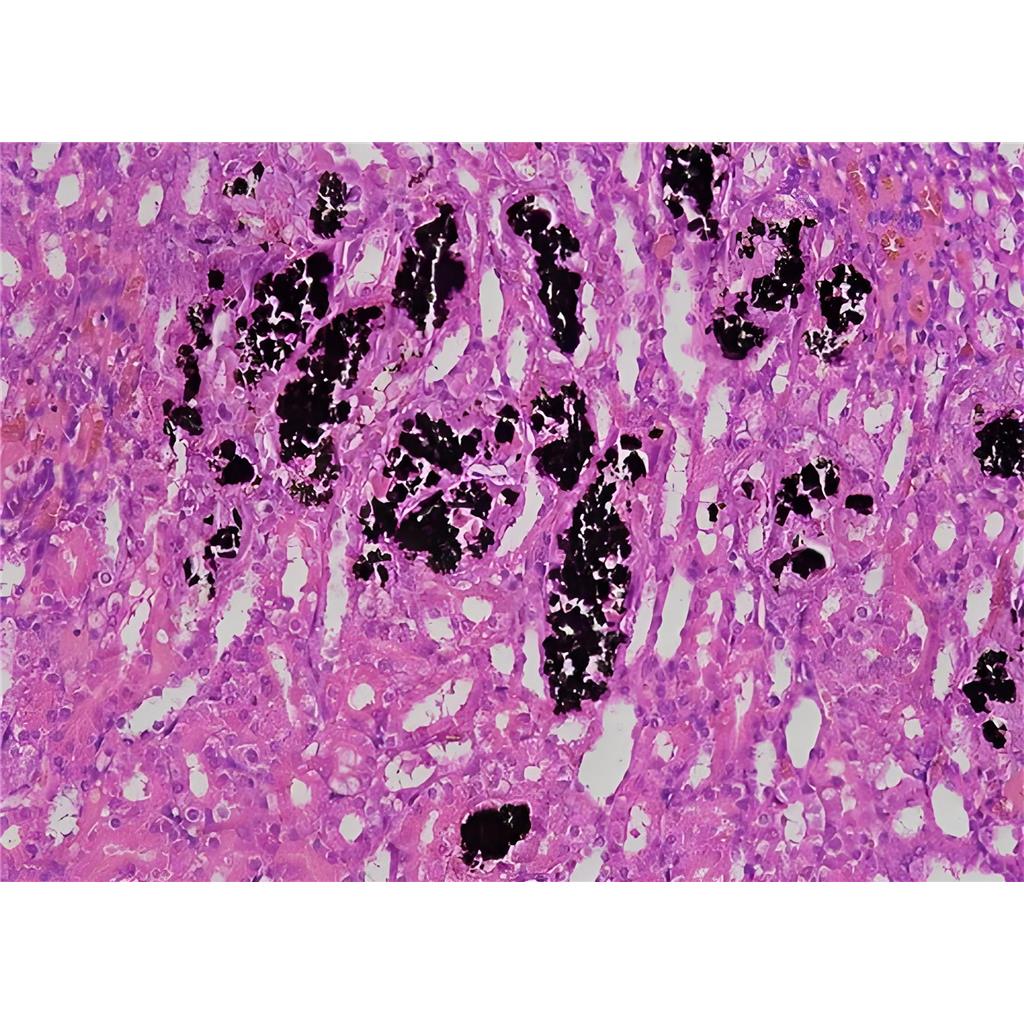 Von Kossa钙盐染色液