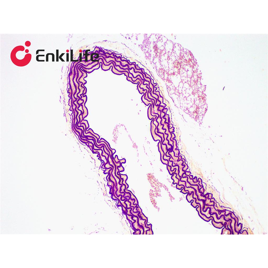 弹力纤维染色液(改良Gomori醛品红法)