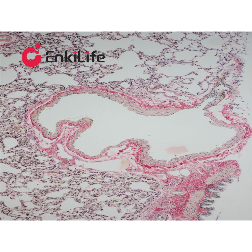 Van Gieson(VG)染色液