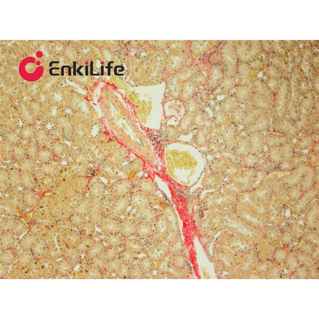 改良Van Gieson(VG)染色液