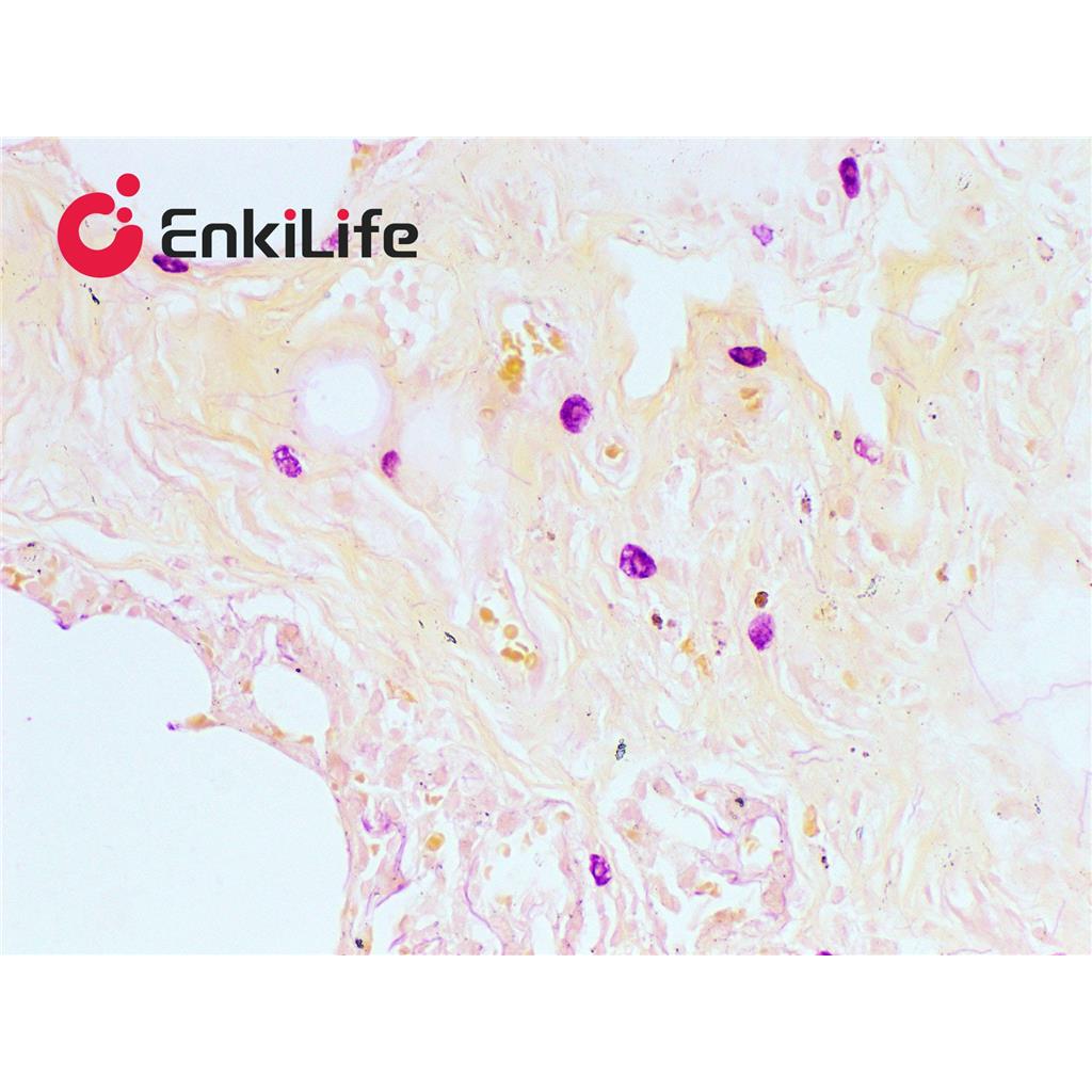 肥大细胞染色液(醛品红-橙黄G法)