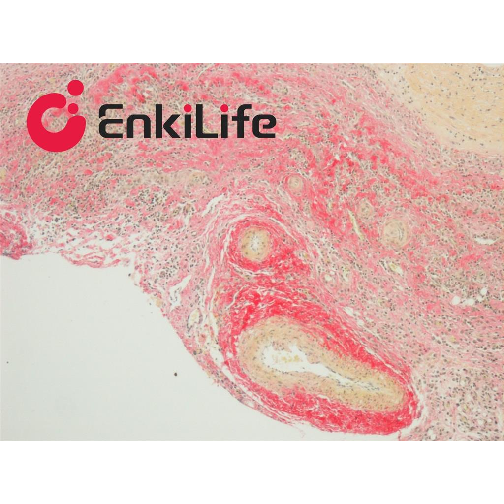 维多利亚蓝胶原纤维染色液