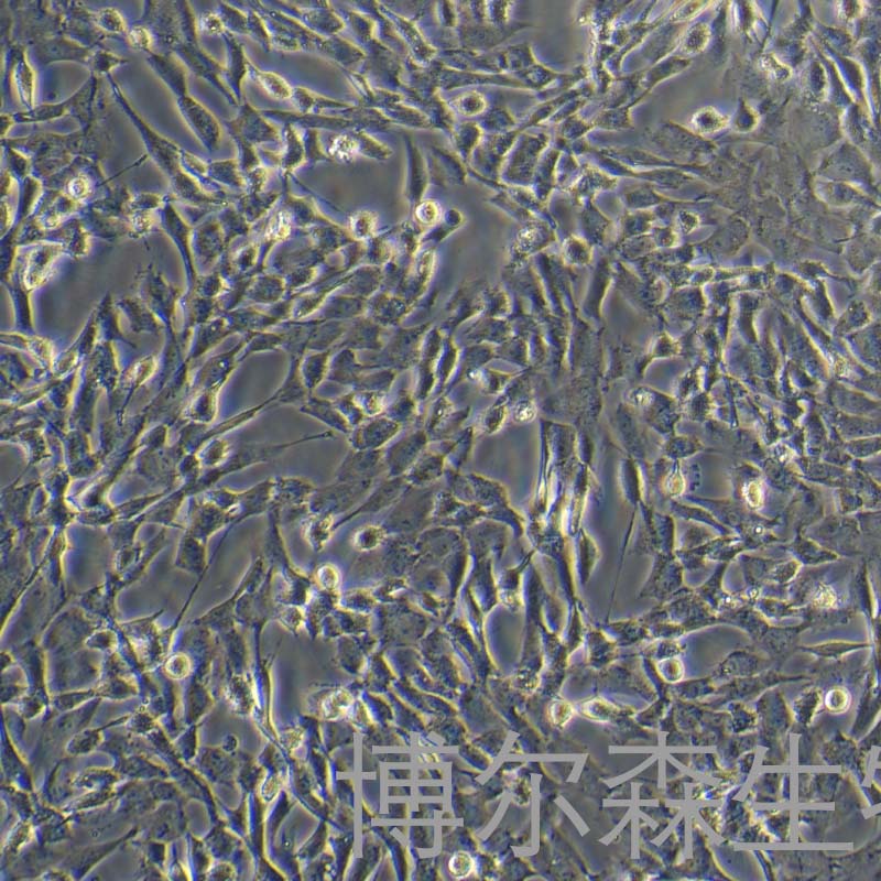 人骨髓间充质干细胞永生化