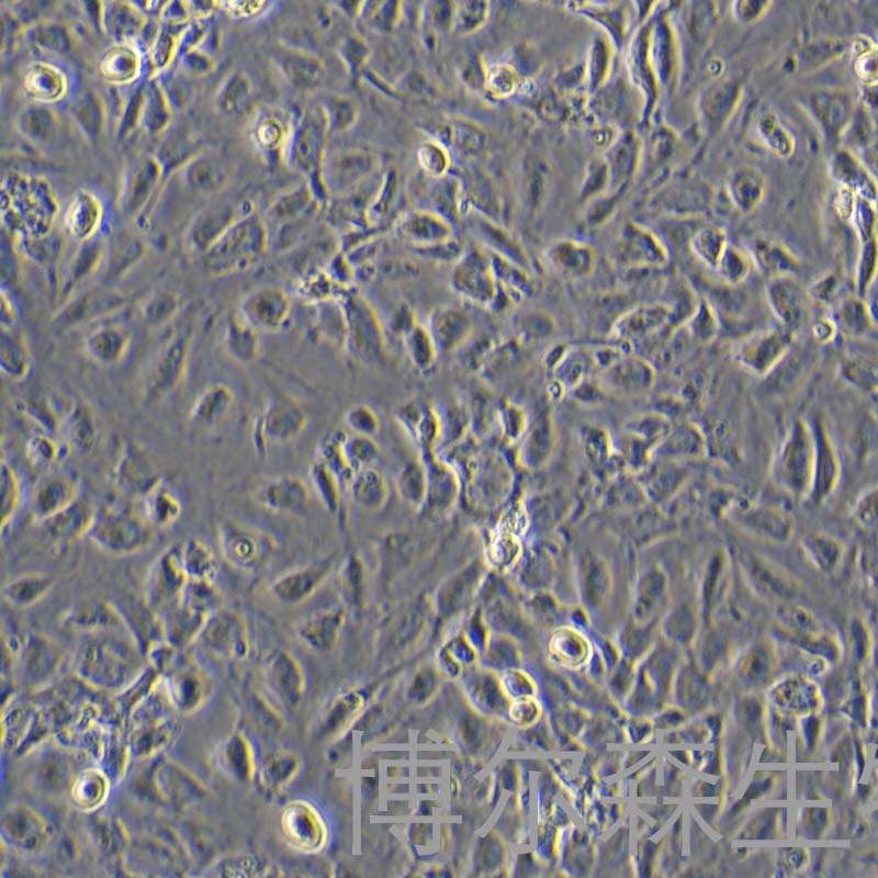 人宫颈上皮永生化细胞