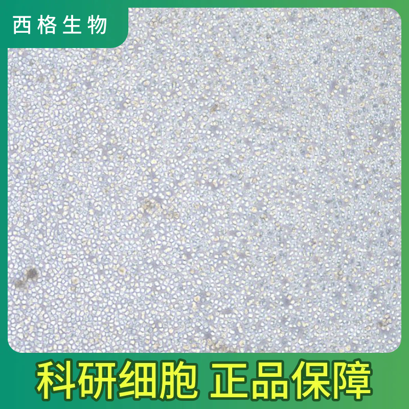 人胎盘绒毛膜滋养层细胞