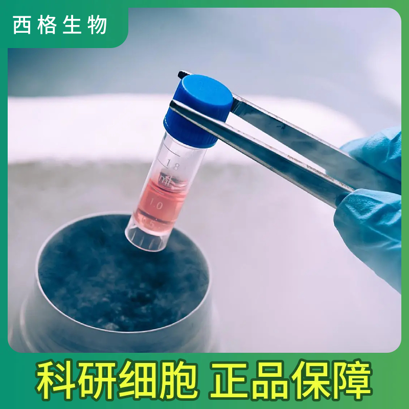 人支气管平滑肌细胞