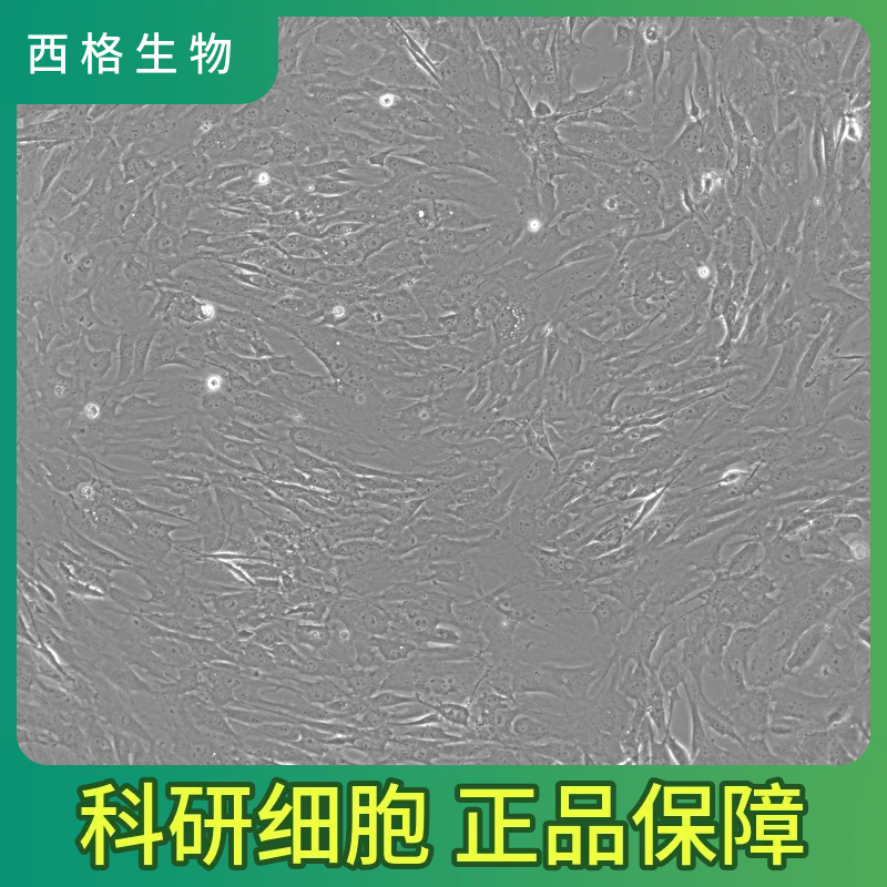 人支气管平滑肌细胞