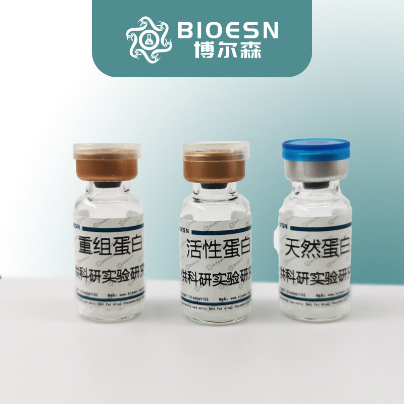 Recombinant Nipah virus/NiV Protein N/Nucleoprotein Protein, N-His