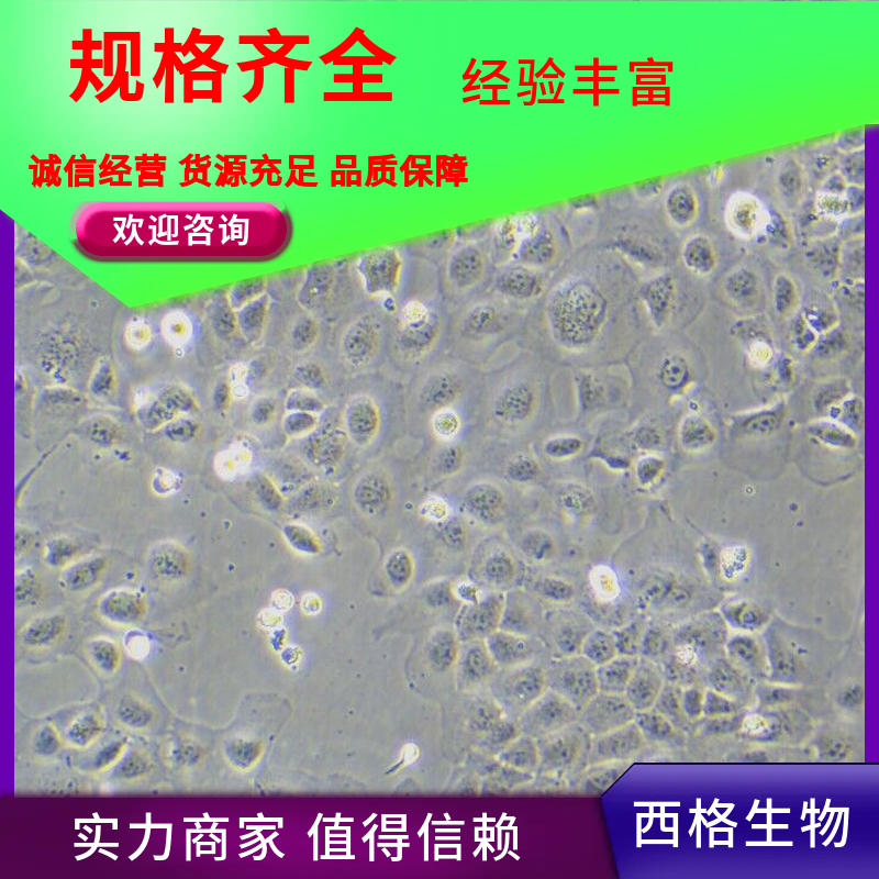 人卵巢成纤维细胞