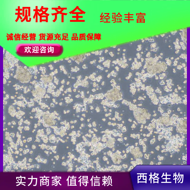 人卵巢微血管内皮细胞