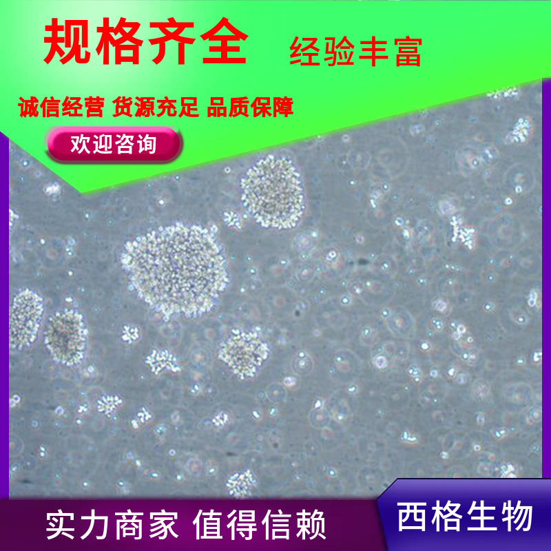 人乳腺成纤维细胞