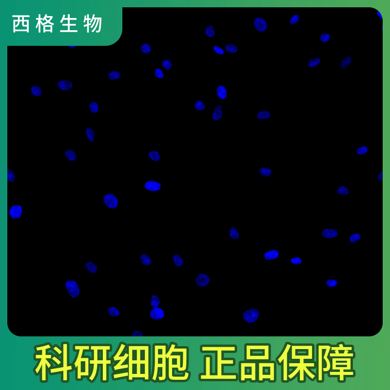 人肾小球系膜细胞