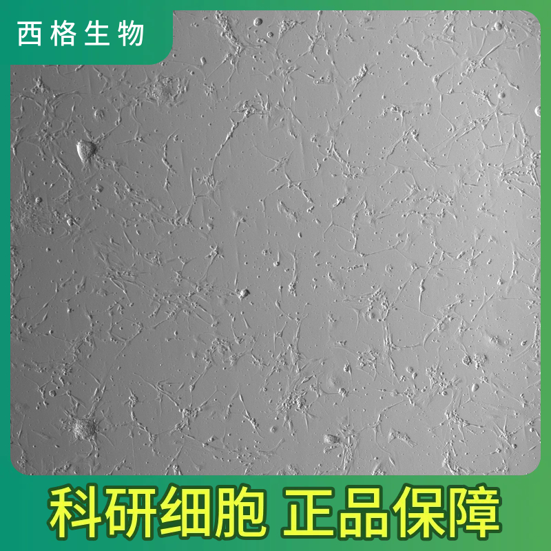 人冠状动脉平滑肌细胞