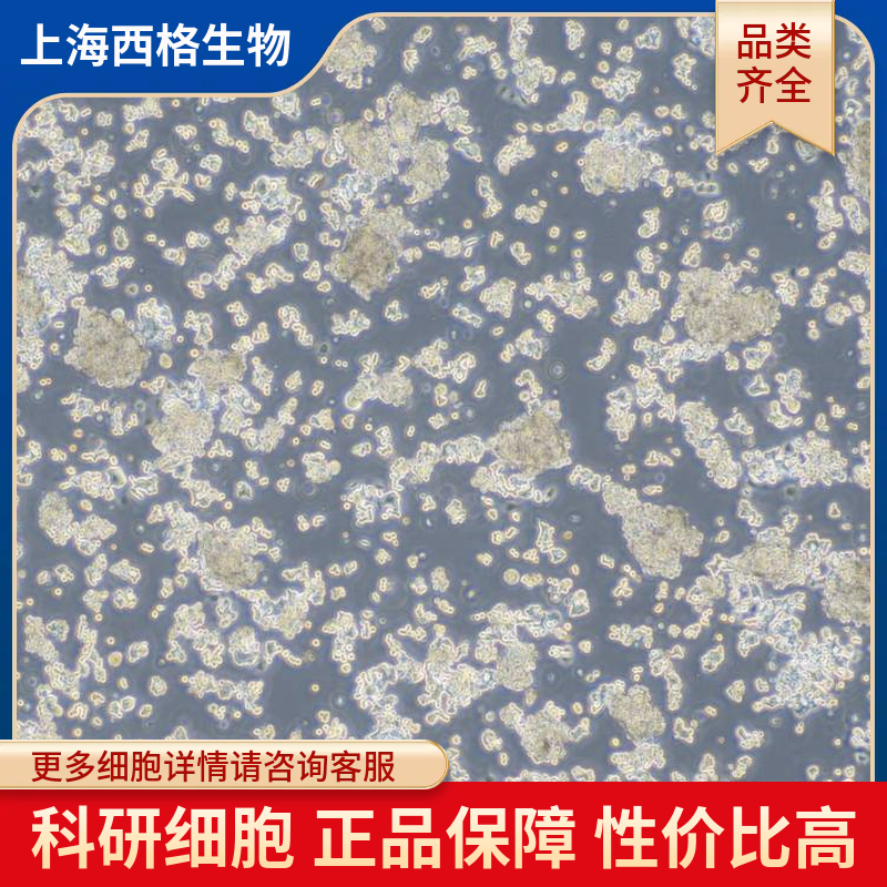 小鼠肺动脉平滑肌细胞