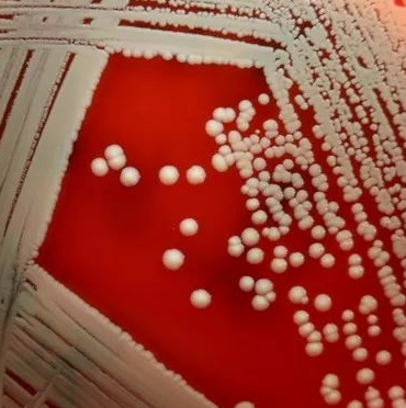 Clostridium Butyricum