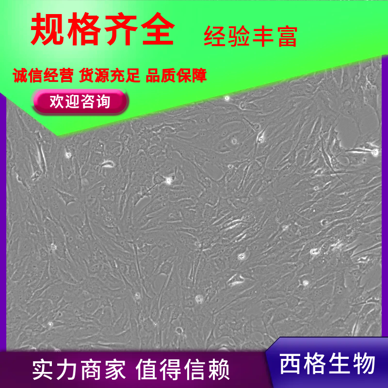 人肝癌相关成纤维细胞