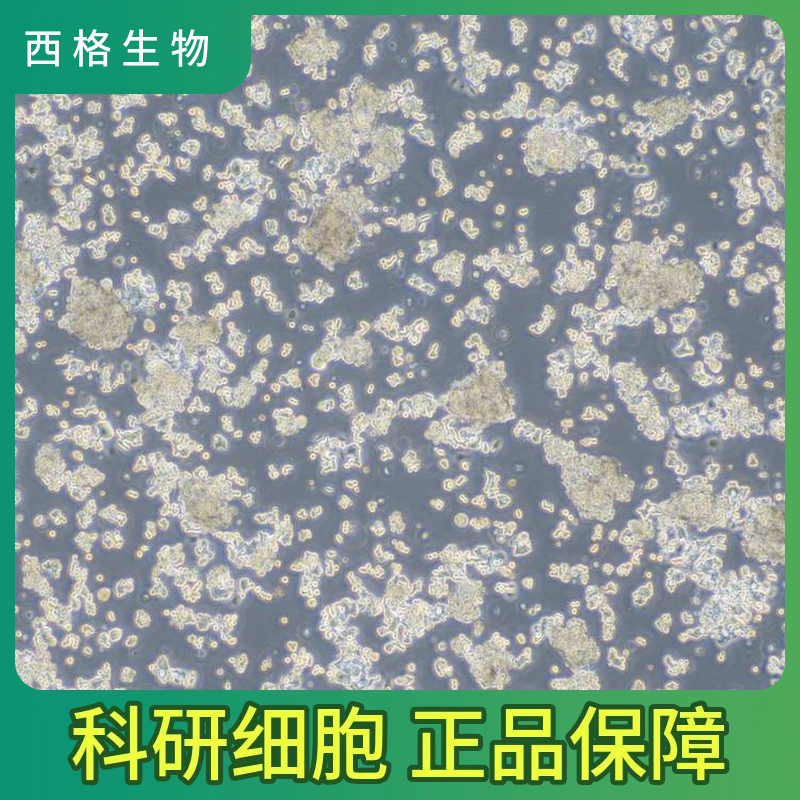 人脐血间充质干细胞