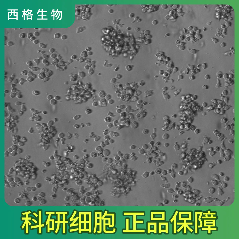 人关节滑膜成纤维细胞