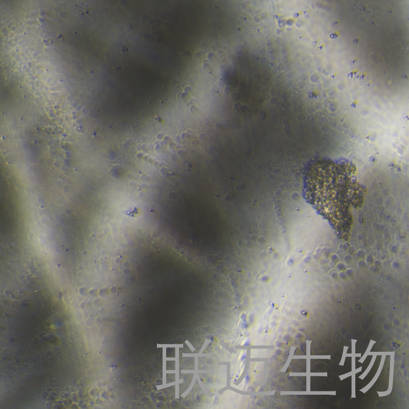 ECC12细胞（人小细胞胃癌细胞）LM8C1840