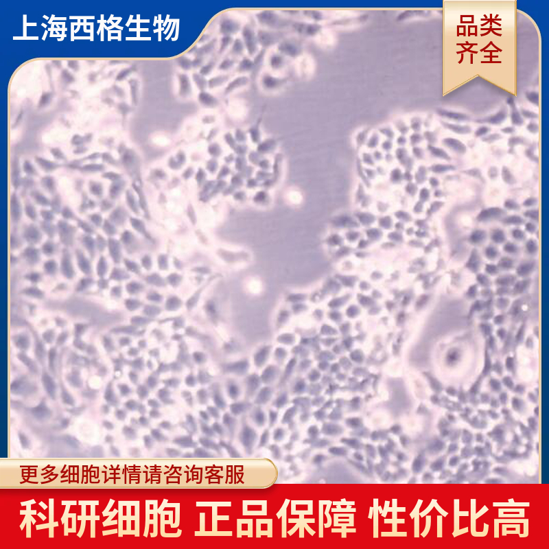 人附睾平滑肌细胞