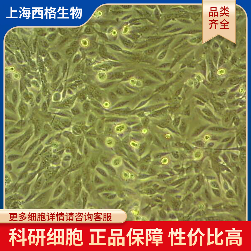 人输精管平滑肌细胞