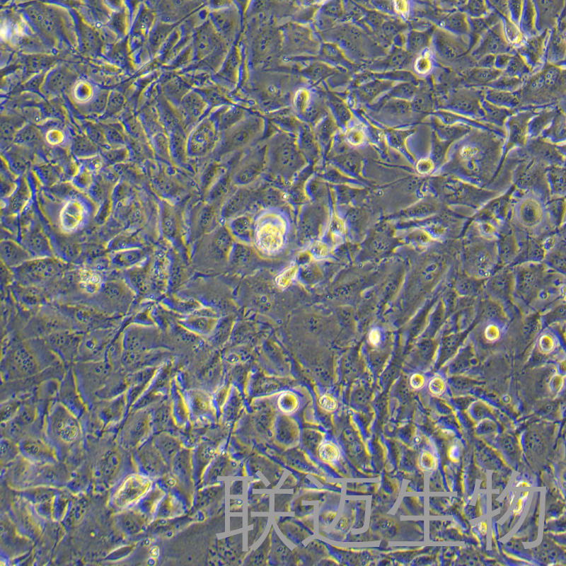 CAL-120细胞（人乳腺癌细胞）LM8C1877