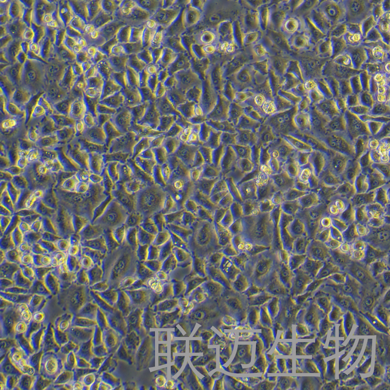 SNU668细胞（人胃癌细胞）LM8C1919