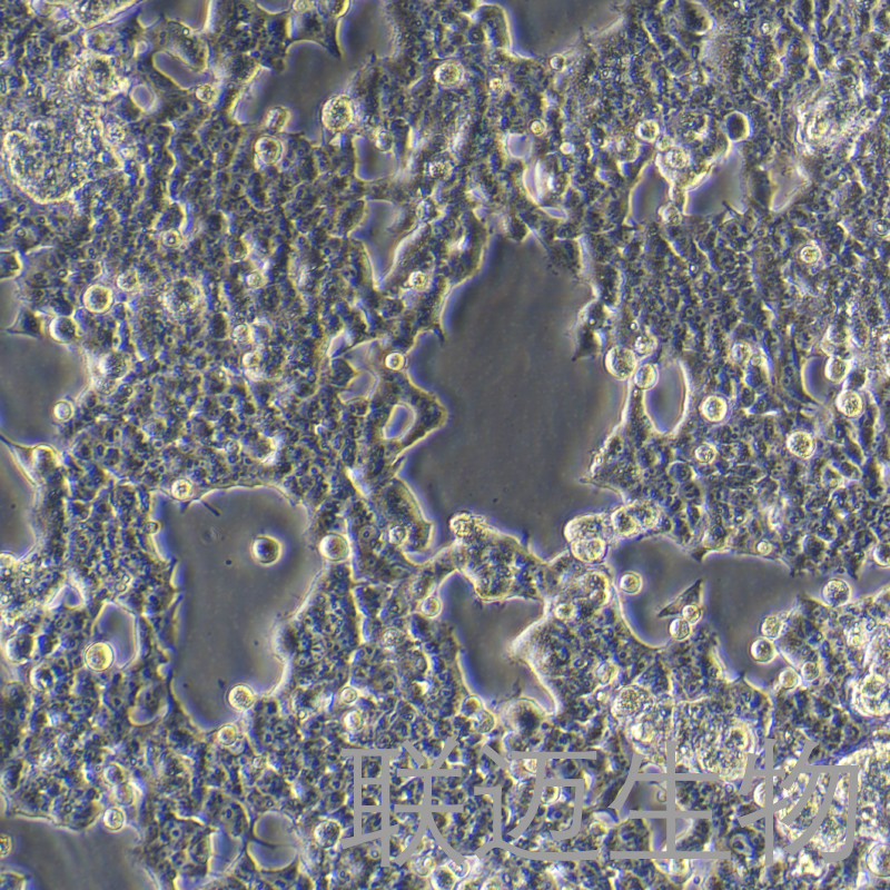 HEK-293T-ACE2细胞（人胚肾细胞稳转ACE2 过表达）LM8C1976