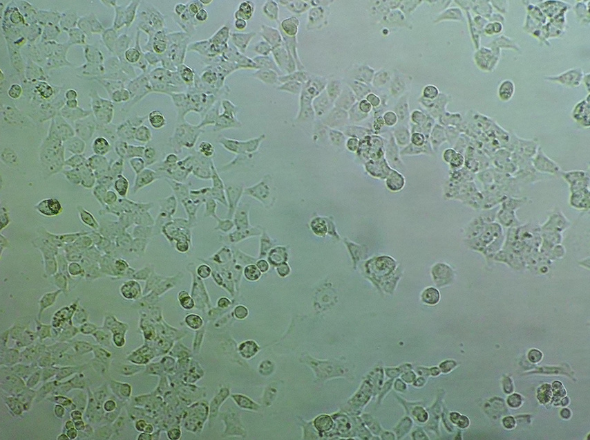 HCT-116细胞（DSMZ）