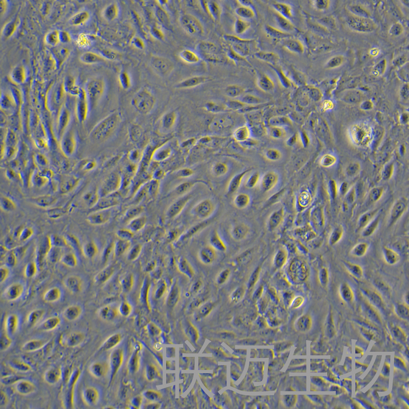HUVEC-SV40T细胞（人脐静脉内皮细胞（永生化））LM8C2048