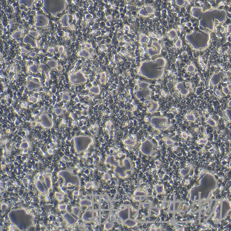 Phoenix-AMPHO细胞（人肾上皮细胞）LM8C1995
